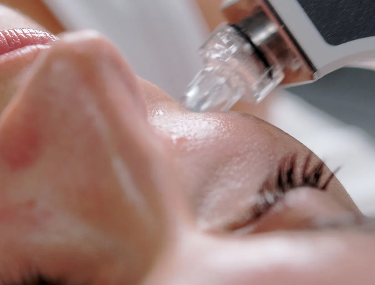 Oxygen Ice Peel