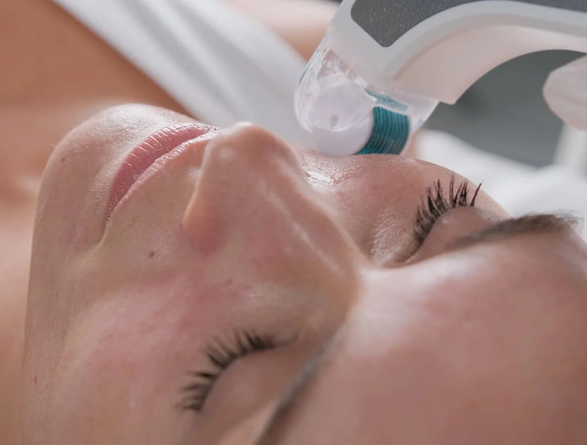 Oxygen Ice Needling met dronetechnologie